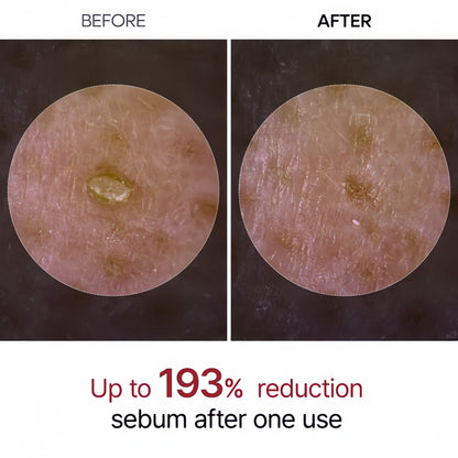 Dr-MalexIn Peel Shot Glow Rice Ampoule Black+Toner Set